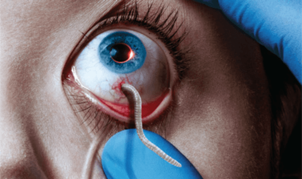 The Strain (2014) 1 – the Strain